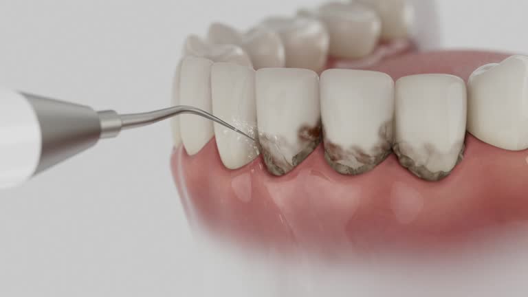 Reliable Dental contractor in Union City, OH by Dentist Open Now